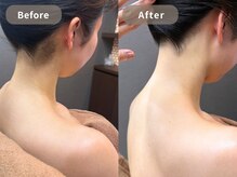 スパ アンド シェイブ 4K(SPASHAVE 4K)/骨格に合わせてつくる　美えり足