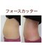 リノ(Lino)の写真/ラジオ波で深層部へアプローチ◎痩身、ぽっこりお腹もスッキリ！理想のボディライン作りをサポート♪