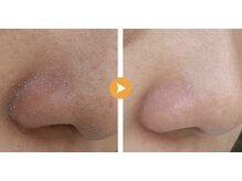 ラ ピュア ビン(LA PURE BIN)/参考写真