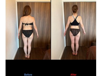 カオン(Kaon)/ハイパー痩身全身