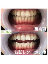 ルブラン 奈良店(Le Blanc)/口コミから広がる当店！！