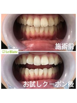 ルブラン 奈良店(Le Blanc)/口コミから広がる当店！！