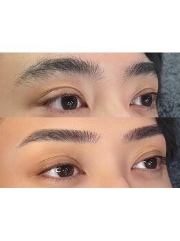 メンズフェイシャル