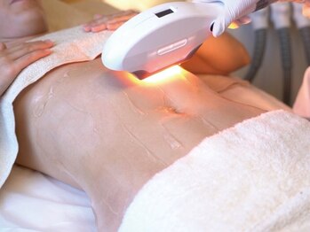 シャルム(Charme)/日焼け肌でも脱毛できます!