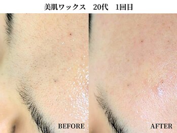 サンビ(SANBI)/勘違い黒ずみ？！