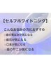 【セルフホワイトニング】たった1回で即効果実感◎短期間で真っ白な歯に♪