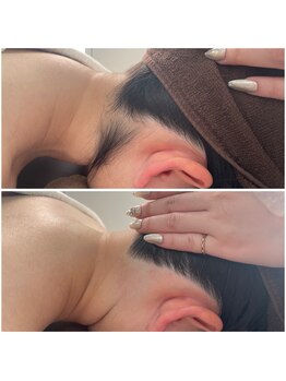 ミース 北九州店/うなじ◎ビフォーアフター