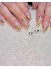 トゥリートップ(Treetop)/