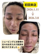 ルポ(Repos)/レディースエステシェービング