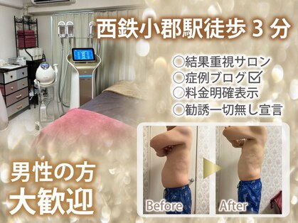 シュシュ(CHUCHU)の写真