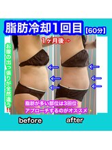 ビューティ ウィッチ(Beauty Witch)/