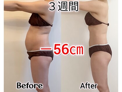 チャーム(Charm)の写真
