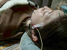 助ルポ鍼灸院