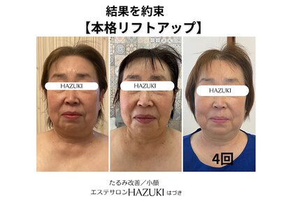 ハズキ(HAZUKI)の写真