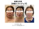 ハズキ(HAZUKI)の写真