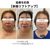 ハズキ(HAZUKI)