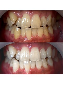 ワールドビューティー(World Beauty)/30代男性/ホワイトニング