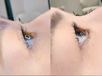 アイラッシュ バイ リノ(Eyelash by:Lino)の写真/瞼が下がってきている方、一重瞼、二重の線をはっきりさせたい！こんなお悩みをお持ちの方必見！