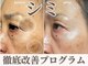 スイッチ(Switch)の写真