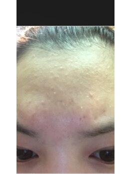 アイエステ(Ai esthe)/