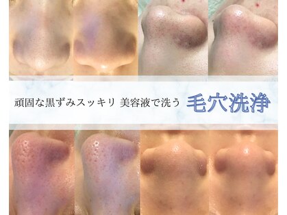ミューズ(MUISE)の写真
