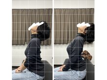 ナオル整体 平塚院(NAORU整体)/一回の施術で真上を向けるように