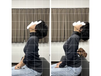 ナオル整体 平塚院(NAORU整体)/一回の施術で真上を向けるように