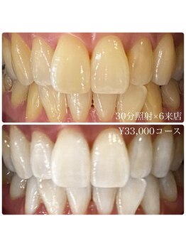 ホワイトニングルーム 横浜店(Whitening Room)/ホワイトニング/横浜