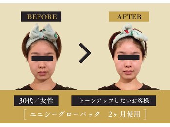 キレイ 筑紫野原田店(KIREI)/30代 トーンアップしたい