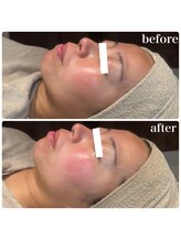 ディオーネ 春日井勝川店(Dione)/マーメイドセルトリートメント