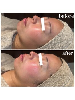 ディオーネ 春日井勝川店(Dione)/マーメイドセルトリートメント