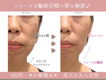 グレースエール トータルビューティーサロン(Grace Aile)/*小顔矯正*