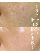 トップスキン 表参道(TOPSKIN)&nbsp;専門店だか らできる技