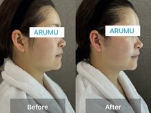 アルム コリア(ARUMU KOREA)/コルギ