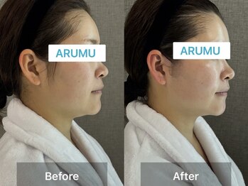 アルム コリア(ARUMU KOREA)/コルギ