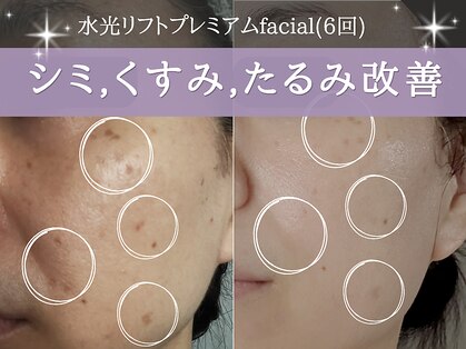 ミトラ(MITRA)の写真