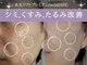 ミトラ(MITRA)の写真