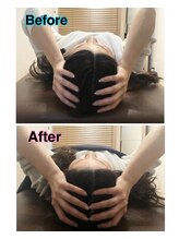 スカイ 鍼灸整骨院 整体院(SKY)/小顔矯正