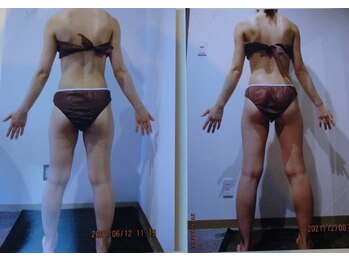 パーフェクトボディプレミアム 大阪梅田店(PERFECT BODY PREMIUM)/お客様 ビフォーアフター(17)