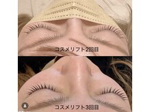 ラソ 束本店(lazo)/【新メニュー】コスメリフト