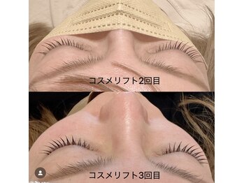 ラソ 束本店(lazo)/【新メニュー】コスメリフト