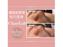 クリアラボ 豊中(Clear Lab)の雰囲気（フォトギャラに韓国式毛穴洗浄のBefore⇒After多数掲載中☆）