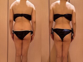 凪 横浜/スリムアトラクション