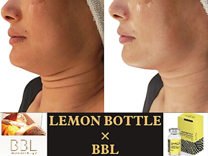ベリッセ(Belisse)の写真