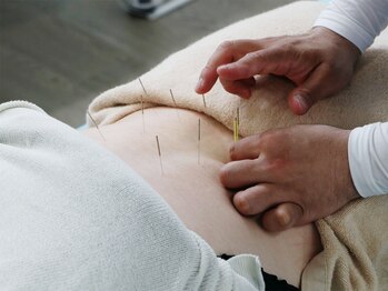 ぺんぎん堂整骨院の写真/鍼灸スタッフ在籍！慢性的な不調や美容のお悩みもご相談ください。鍼灸施術が初めての方にもおすすめ◎