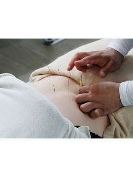 鍼灸施術を受けたい