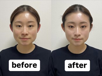 ミルク 池袋(MILK)/お客様before after