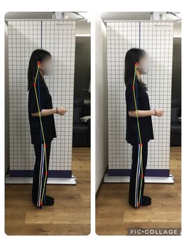 ボディメイク整体院 横浜駅西口店(BodyMake)/施術風景-背中がつらい20代女性-