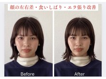 【Google130件以上◎】京都トップレベルの施術効果をお約束！