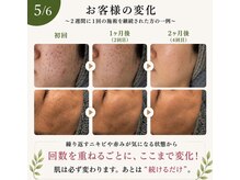 グラースア(grace a)の雰囲気（代謝を超促進するとこんなに早く改善！集中ケアに向いてます！）